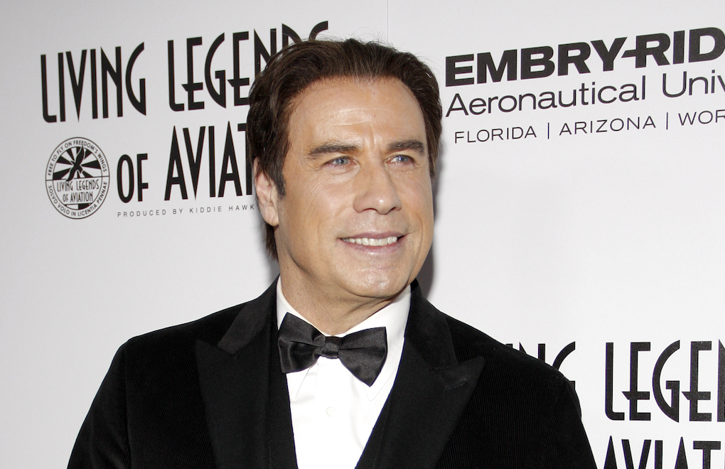 Celebrities Who Have Used Wigs, Hairpieces, or Hair Transplants